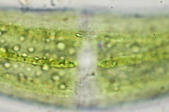 Closterium moniliferum, fijne streping op celwand
