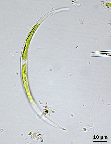 Closterium acutum var. variabile