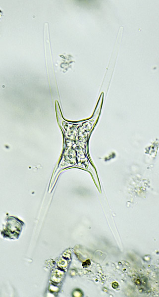 Closterium acutum, zygospore