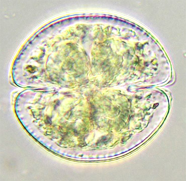 another cell of Cosmarium obsoletum