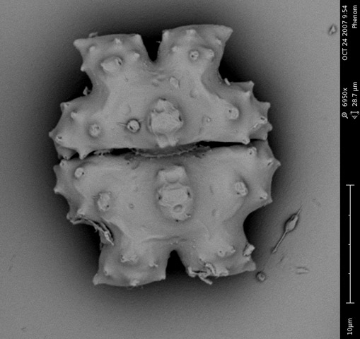 SEM-image of Euastrum denticulatum