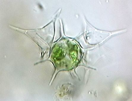 zygospore of Staurodesmus omearae