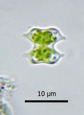 Xanthidium tenuissimum