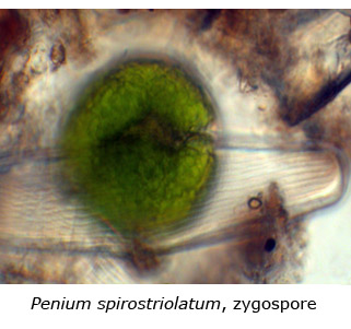 Tekstvak:  Afbeelding 3: Penium spirostriolatum zygospore